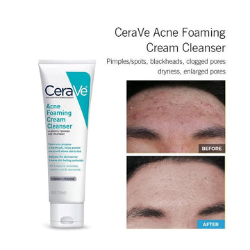 CeraVe 4 in 1 Deal Box | Hydrating Mineral Sunscreen SPF 50 Face Lotion | Skin Renewing Night Cream | Skin Renewing Retinol Serum | Acne Foaming Cream Cleanser